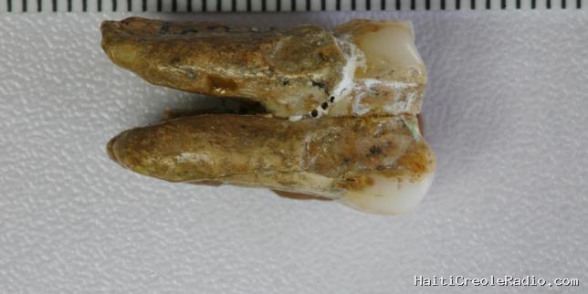 Comment l’émail de dents vieilles de 400 000 ans révèle des croisements de populations d’hominines
