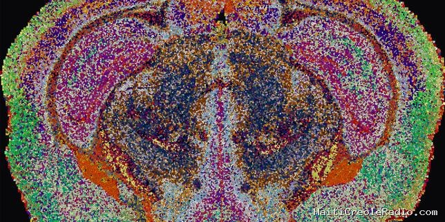 Dans le cerveau, il y a beaucoup de gras : la preuve par l’image