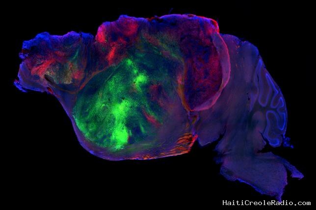 Des souris avec un cerveau mi-humain au service de la médecine